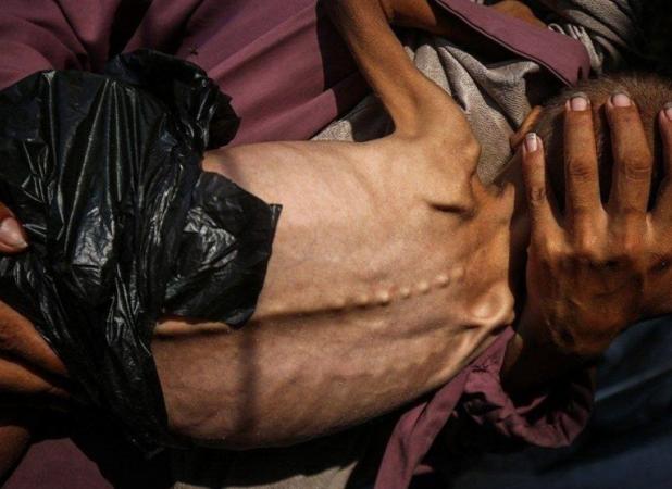 جنگ غزه|جان باختن کودک شیرخوار و موج فزاینده محکومیت‌ها علیه صهیونیست‌ها