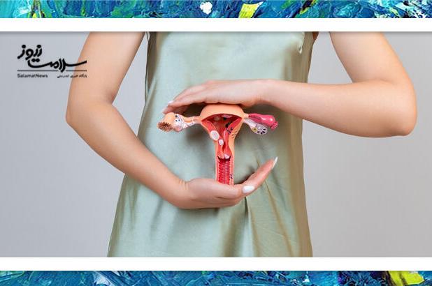 اندومتریوز؛ دردهای شدید دوران قاعدگی که نباید نادیده گرفته شود