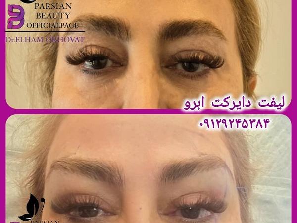 بهترین دکتر لیفت شقیقه در تهران + لیست ۱۰ دکتر برتر