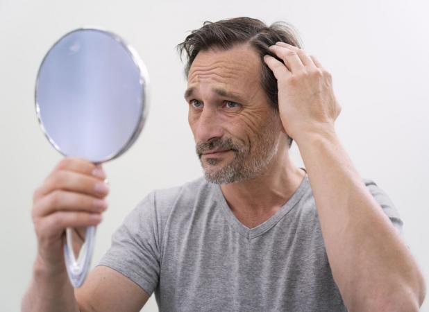 کاشت مو برای آقایان و بانوان؛ چه افرادی کاندید مناسب هستند؟