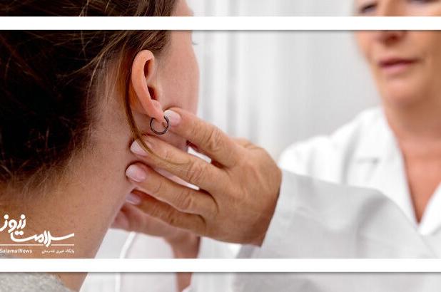 عکس/ هر آنچه باید درباره بیماری بوسه بدانید