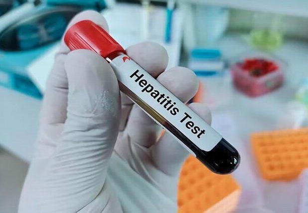 هدف‌گذاری ایران برای حذف هپاتیت C تا ۳سال آینده