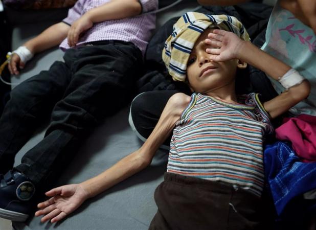 از هر ۱۰ کودک در غزه ۹ کودک از سوء تغذیه رنج می‌برد