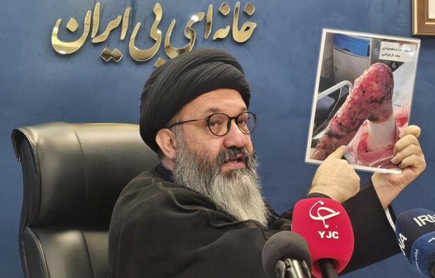 حدود ۱۲۵۰ بیمار ای بی در کشور شناسایی شده اند