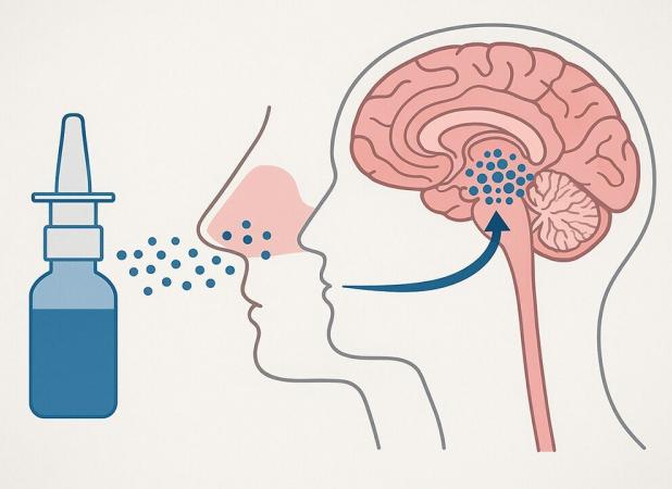 قطرهٔ بینی برای حذف تومورهای مغزی: انقلابی در درمان گلیوبلاستوما بدون نیاز به جراحی
