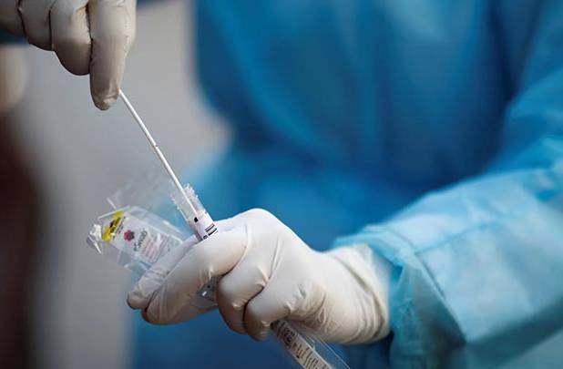 نرخ تست PCR در بخش خصوصی ۳۱۰هزار تومان 