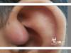 باورهای غلط درباره جرم‌گیری گوش