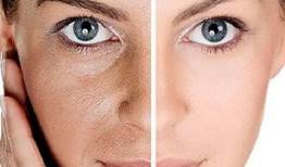 حفظ سلامتی پوست با این روش‌های ساده
