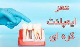 عمر ایمپلنت کره‌ای ( + برند های عمری )