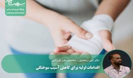اقدامات اولیه برای کاهش آسیب سوختگی