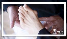 آیا می‌توان انحراف شست پا (بونیون) را بدون جراحی کوچک کرد؟