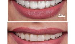 متخصص کامپوزیت دندان چه ویژگی‌هایی دارد؟