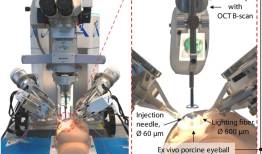 روبات و هوش مصنوعی جراح چشم شدند