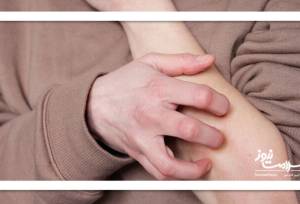 چگونه خارش ناشی از اضطراب را مدیریت کنیم؟