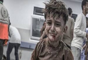 «حکم مرگ تدریجی» ۲۰۰ هزار مجروح غزه چگونه امضا می‌شود