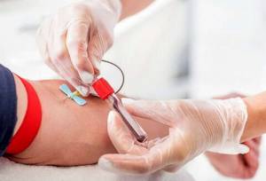 افت اهدای خون در روزهای پایانی سال