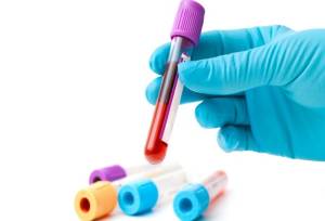 گفت و گو با مردی که خونش در ایران کمیاب‌تر از الماس است