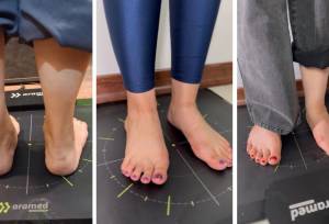 اسکن سه‌بعدی کف پا در منزل امکان پذیر است ؟