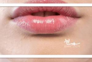 چرا لب‌ها نازک می‌شوند؟