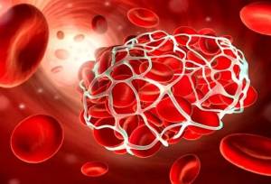  بیماران هموفیلی، همچنان منتظر باشند/ کمبودهای دارویی سراسری است 