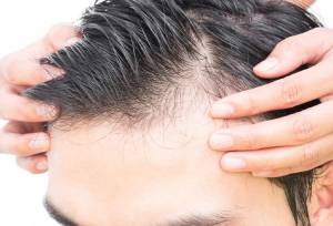 معجزه گیاه چینی: ریزش مو به تاریخ پیوست!