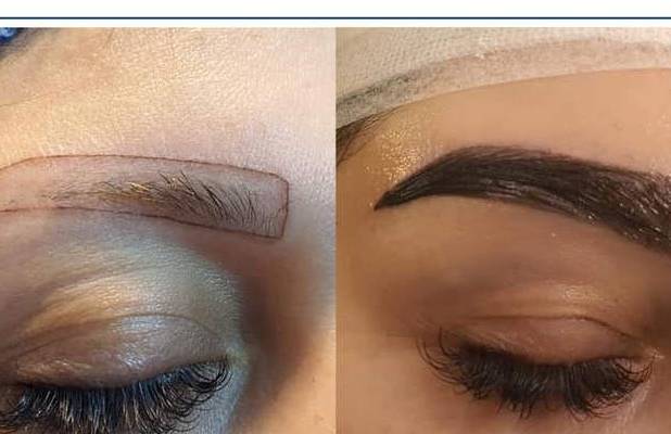 چگونه بهترین کلینیک کاشت ابروی ایران را انتخاب کنم؟