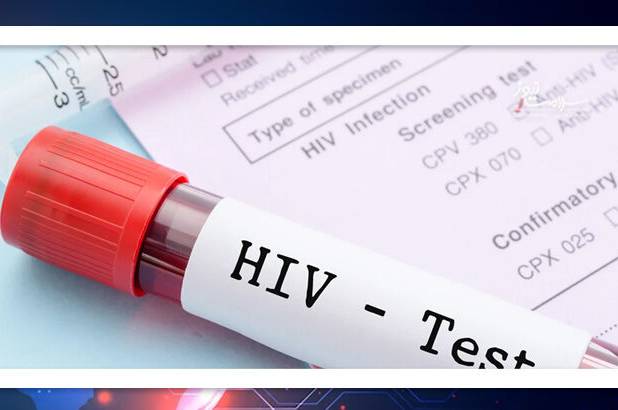 مصرف مواد تفننی و رفتارهای جنسی پرخطر، ریسک HIV را افزایش می‌دهند