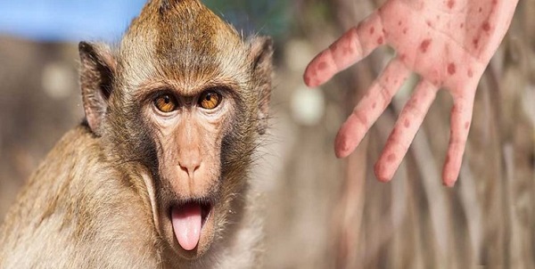 جهش غیر عادی و سریع ویروس آبله میمونی 
