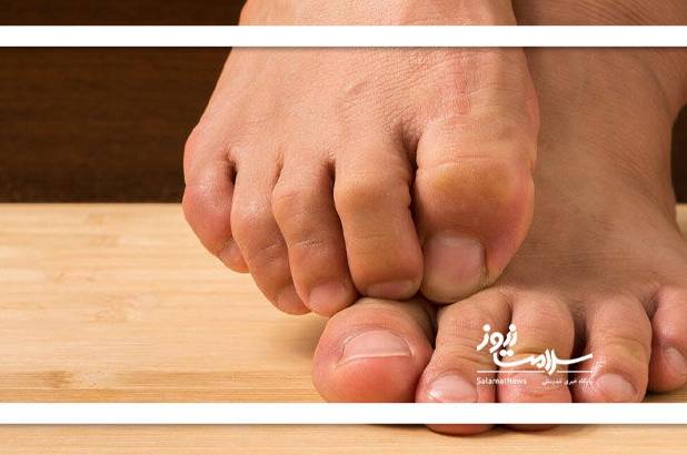 چگونه پاها را قوی کنیم؟