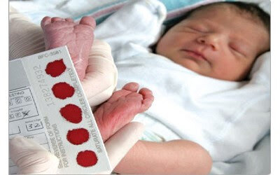 غربالگری زودهنگام، ناجی آینده کودکان/  ۹۶ نوزاد زاهدانی از عقب‌ماندگی ذهنی نجات یافتند