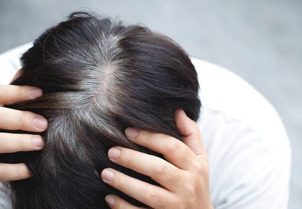 نشانه احتمالی ابتلا به پارکینسون در موها پنهان است