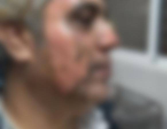 تصویری از جراحت شدید لکوموتیوران قطار اصفهان