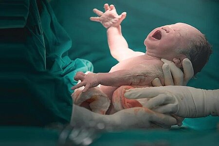 افزایش موارد زایمان‌ در منزل در جمعیت ایرانی؛ هشدارهای بهداشتی و پیامدهای احتمالی