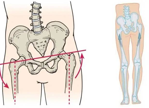 حرکات اصلاحی چرخش لگن راهکار علمی برای بهبود تعادل بدن و کاهش درد