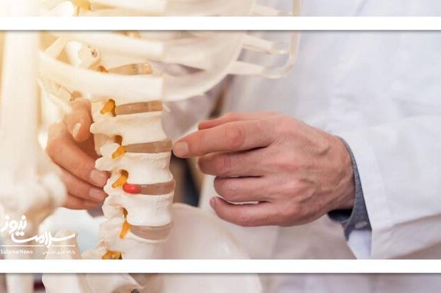 «سیاتیک» چگونه درمان می‌شود؟