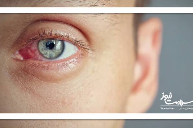 اورژانس خانگی مصدومین ستون فقرات و چشم
