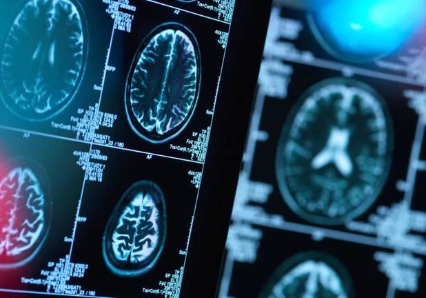 هشدار به بیماران صرعی و آسمی درباره قطع دارو در ایام روزه‌داری