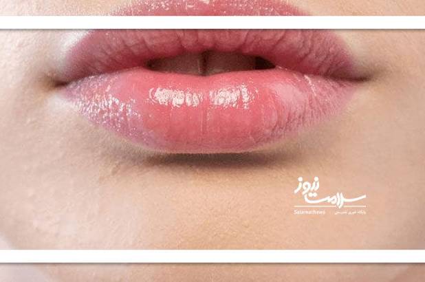 چرا لب‌ها نازک می‌شوند؟