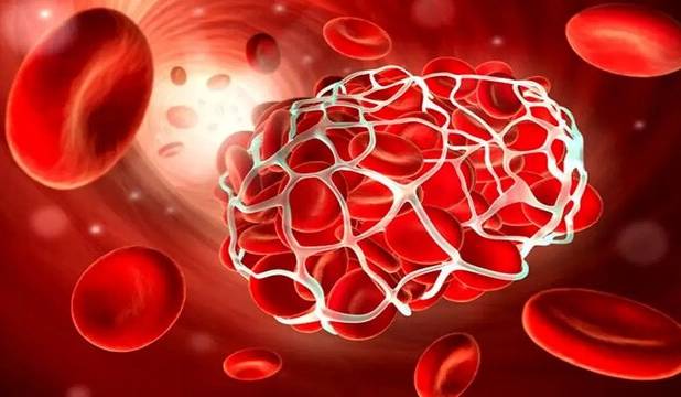  بیماران هموفیلی، همچنان منتظر باشند/ کمبودهای دارویی سراسری است 