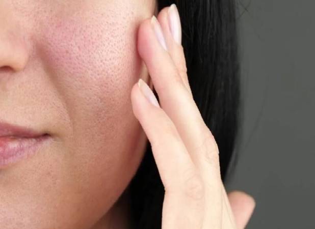 اشتباهات رایج در انتخاب کرم برای منافذ باز پوست