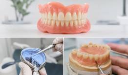 دندان مصنوعی متحرک؛ نکاتی که پیش از ساخت باید بدانیم