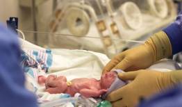 بهبود وضعیت نوزاد و شرایط روحی والدین، با اجرای مراقبت خانواده‌محور در NICU