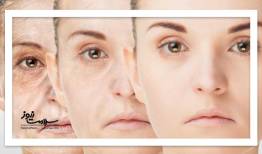 چگونه جوانسازی را تقویت کنیم؟