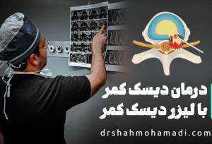 چگونگی درمان دیسک کمر با لیزر دیسک کمر PLDD و توصیه‌های جراح متخصص