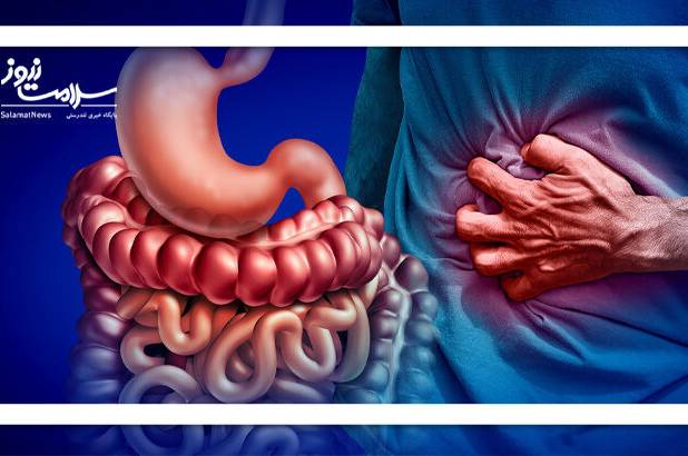بیماری‌های التهابی روده (IBD) بعد از جراحی دوباره برمی‌گردند؟