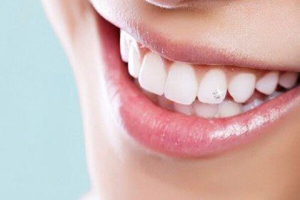 تولید نسل جدیدی از کامپوزیت‌های نانو ساختار 