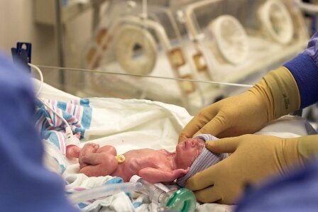 بهبود وضعیت نوزاد و شرایط روحی والدین، با اجرای مراقبت خانواده‌محور در NICU