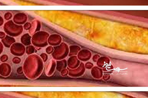 بالا رفتن تری‌گلیسرید در بدن چه خطری دارد؟