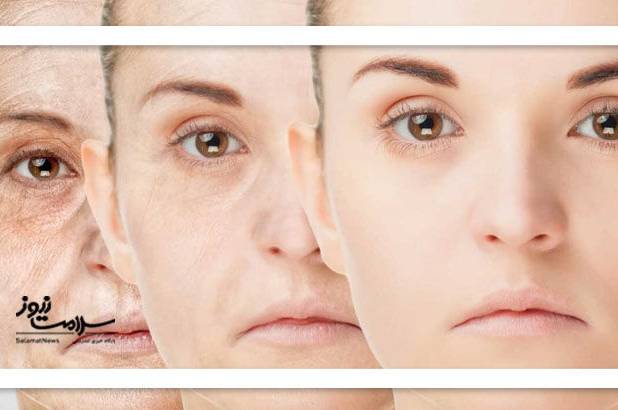 چگونه جوانسازی را تقویت کنیم؟